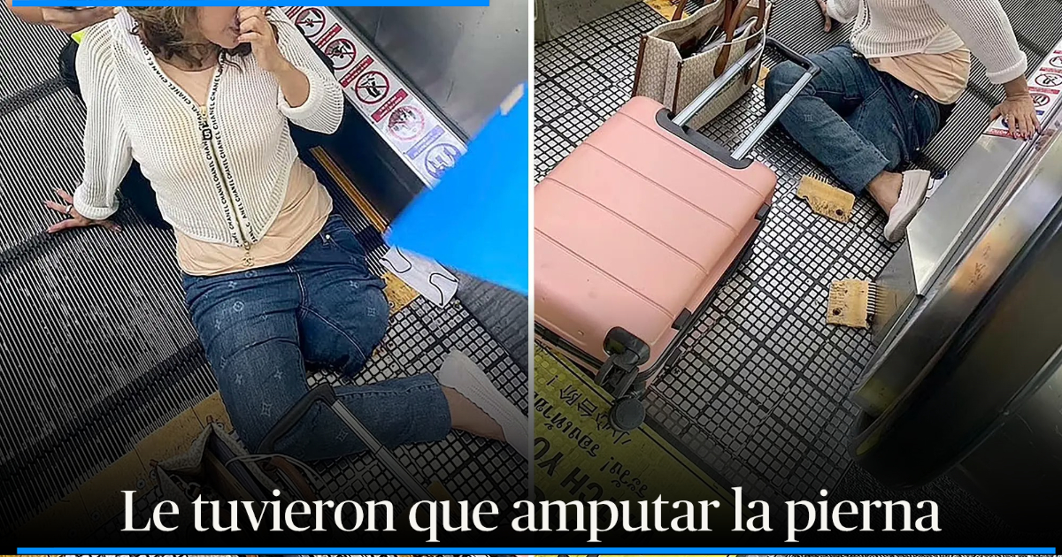 A Mujer Le Amputaron Su Pierna Tras Quedar Atorada En Las Escaleras